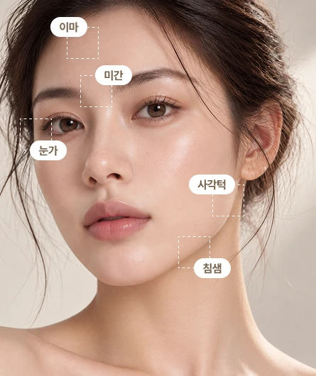 얼굴 보톡스 시술 부위